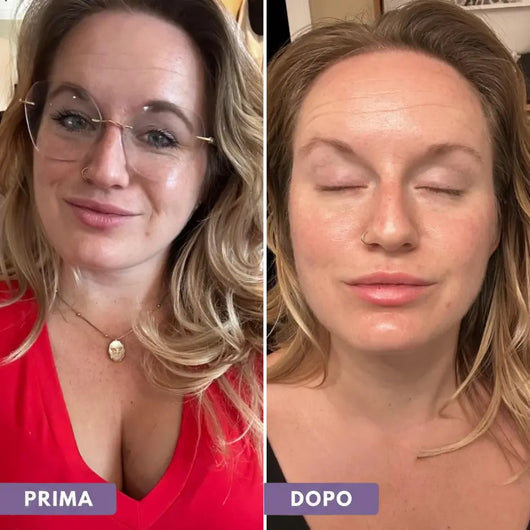 Aurely Bio-DNA: Siero PDRN Orb