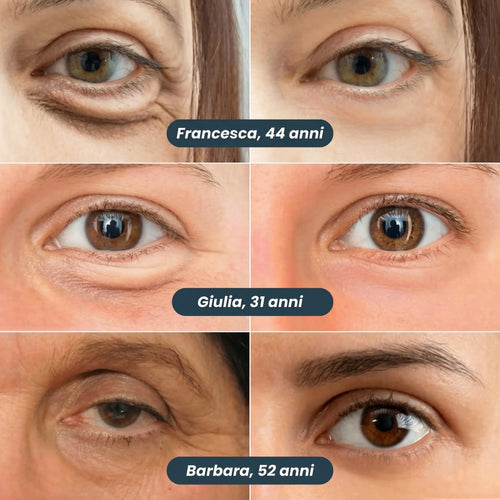 Patch Anti-Occhiaie Nuova Generazione